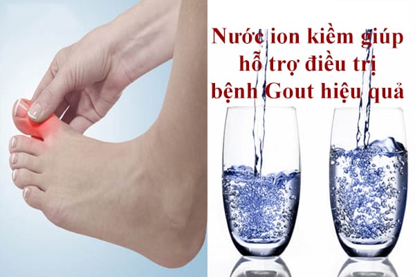 Nuoc-kiem-giup-ho-tro-dieu-tri-benh-Gout-hieu-qua