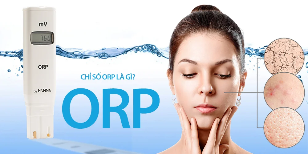 Orp-la-gi